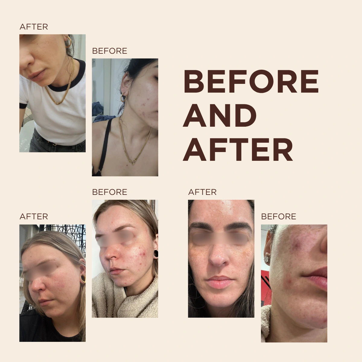 SKIN RESET