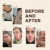 SKIN RESET